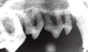 Dental X-ray: example of bone loss. Photo courtesy of www.dentalvet.com